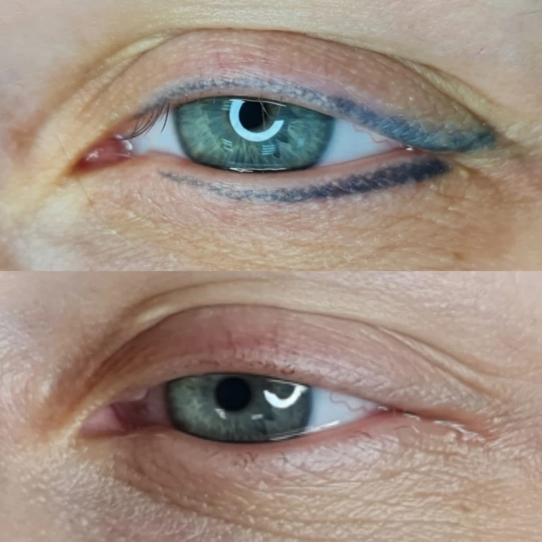 Close-up-of-two-images-showing-the-same-eye