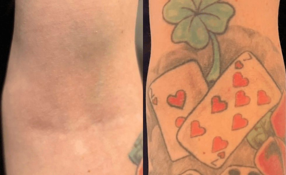 תמונות-לפני-אחרי-לגלריה-2